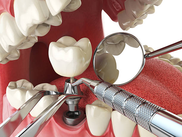 Best Emergency Broken Tooth Repair in Twin Rivers, NJ